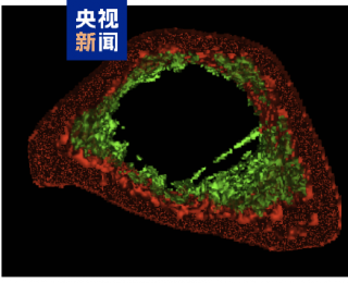 我国科学家在灵长类抗衰老研究领域获新进展