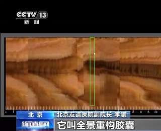 手术机器人、胶囊机器人……当AI赋能医疗 科技与健康双向奔赴