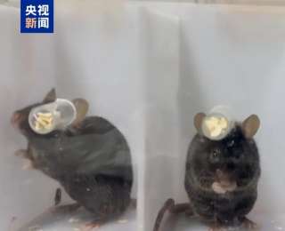 中国科学家揭示左撇子成因